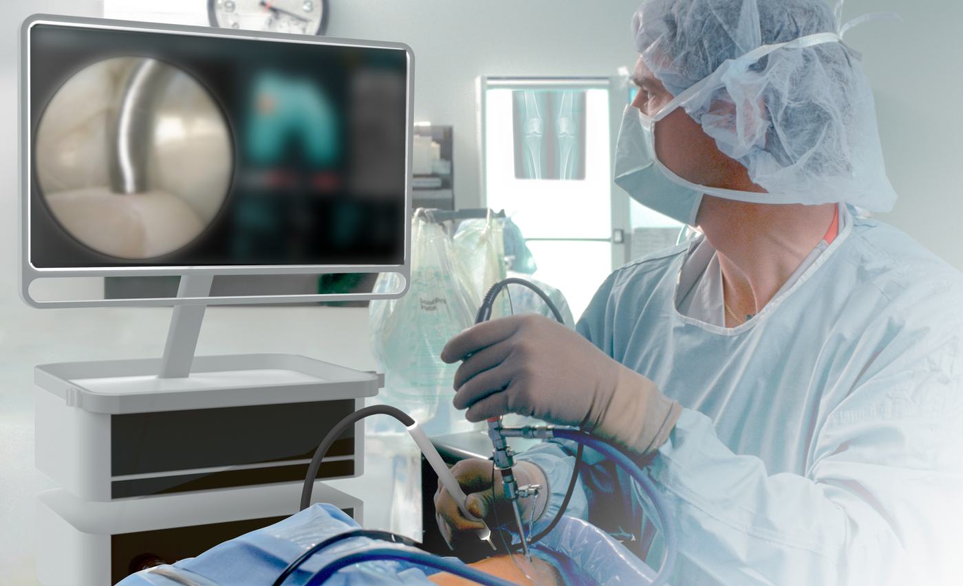 Concept visualisation of a surgeon holding an arthroscope and a hook-shaped probe next to a monitor with blurred content